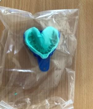 Place impression tray in bag provided